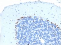 Formalin-fixed, paraffin embedded mouse brain sections stained with 100 ul anti-SOX2 (clone SOX2/1791) at 1:300. HIER epitope retrieval prior to staining was performed in 10mM Citrate, pH 6.0.